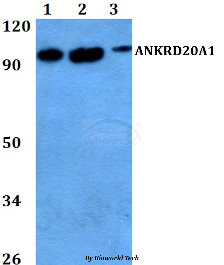 Anti-ANKRD20A1 Antibody