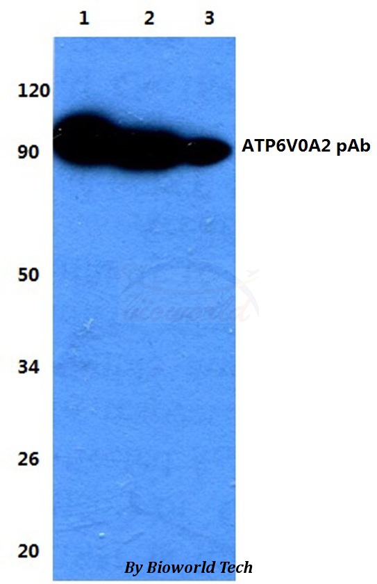 Anti-ATP6V0A2 Antibody