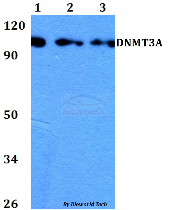 Anti-DNMT3A Antibody