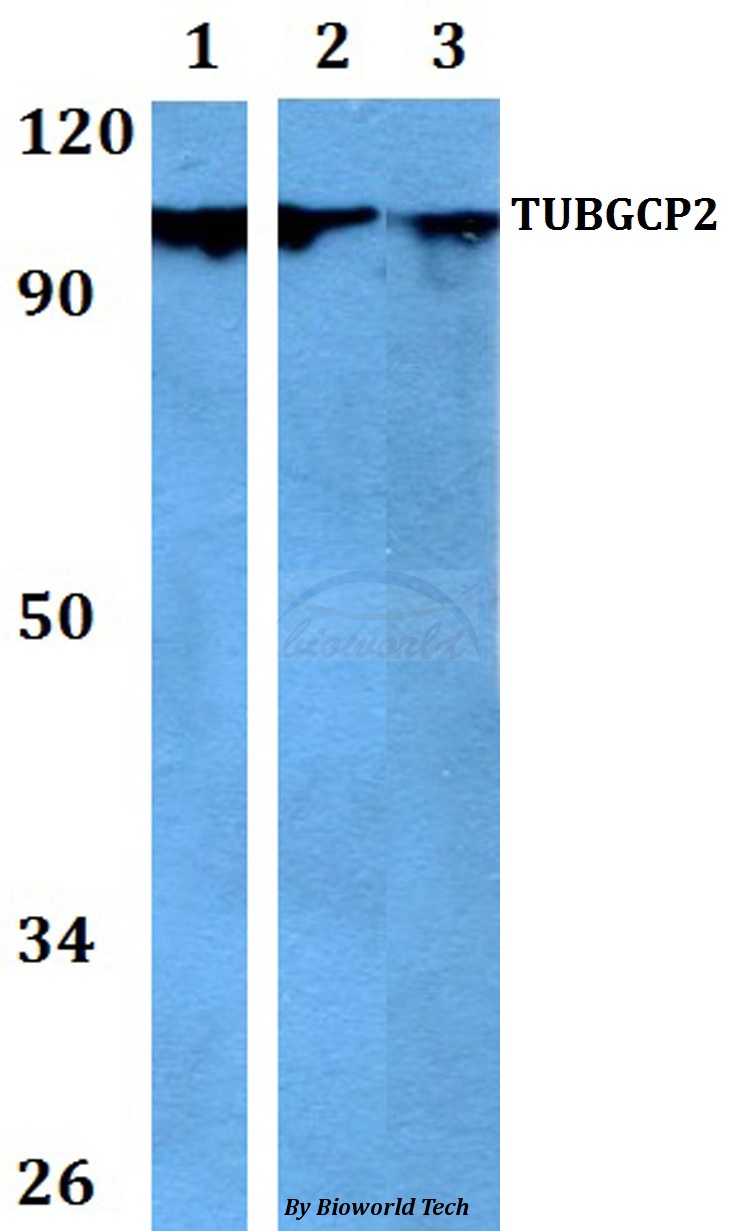 Anti-TUBGCP2 Antibody