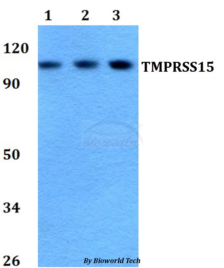 Anti-TMPRSS15 Antibody