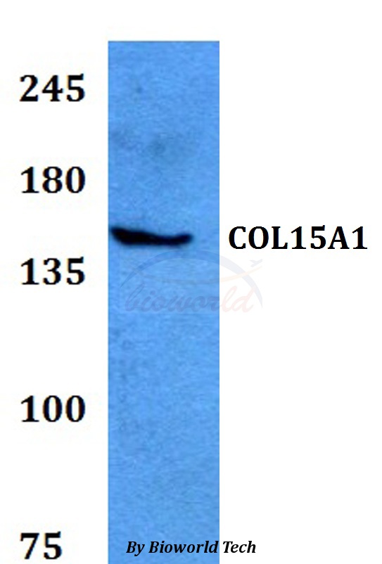 Anti-COL15A1 Antibody