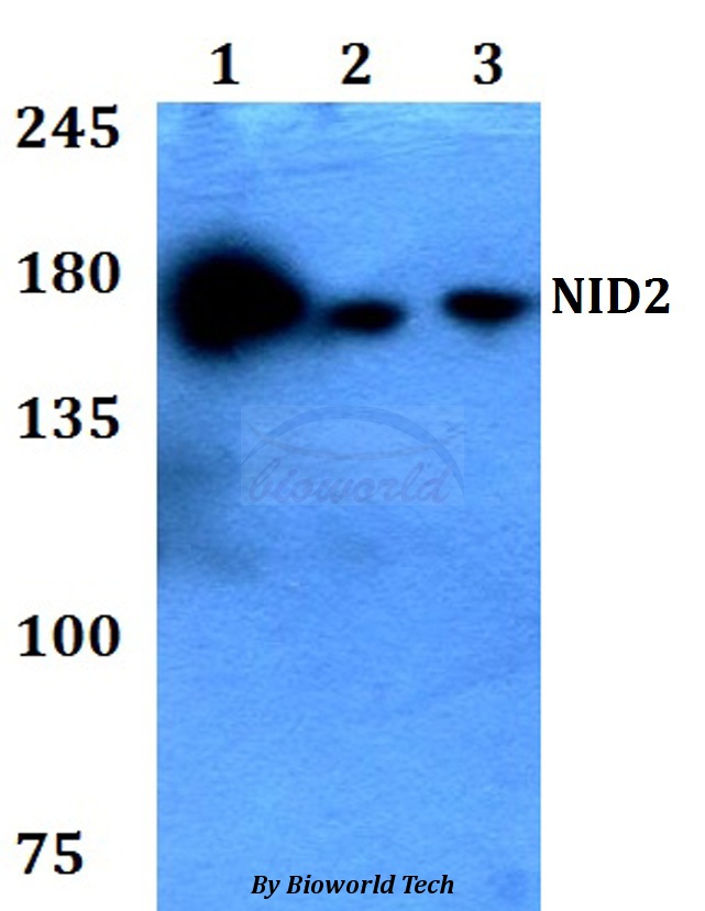 Anti-NID2 Antibody