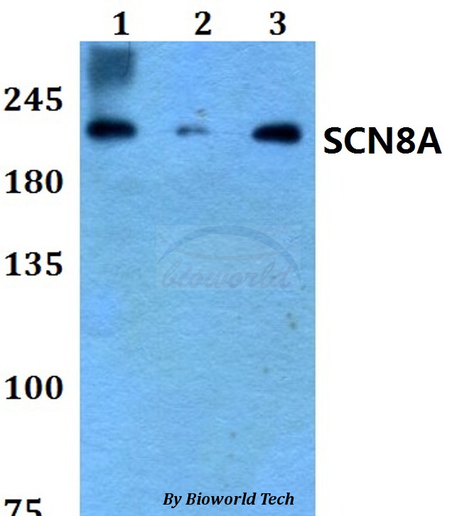 Anti-SCN8A Antibody