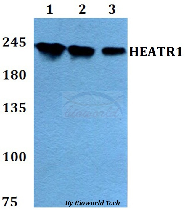 Anti-HEATR1 Antibody