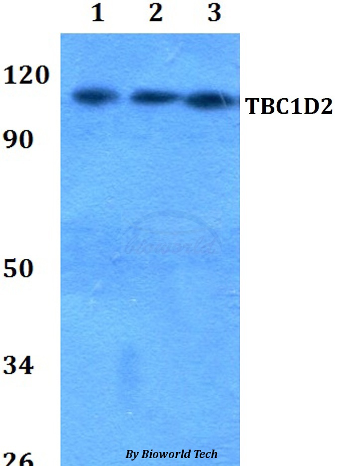 Anti-TBC1D2 Antibody