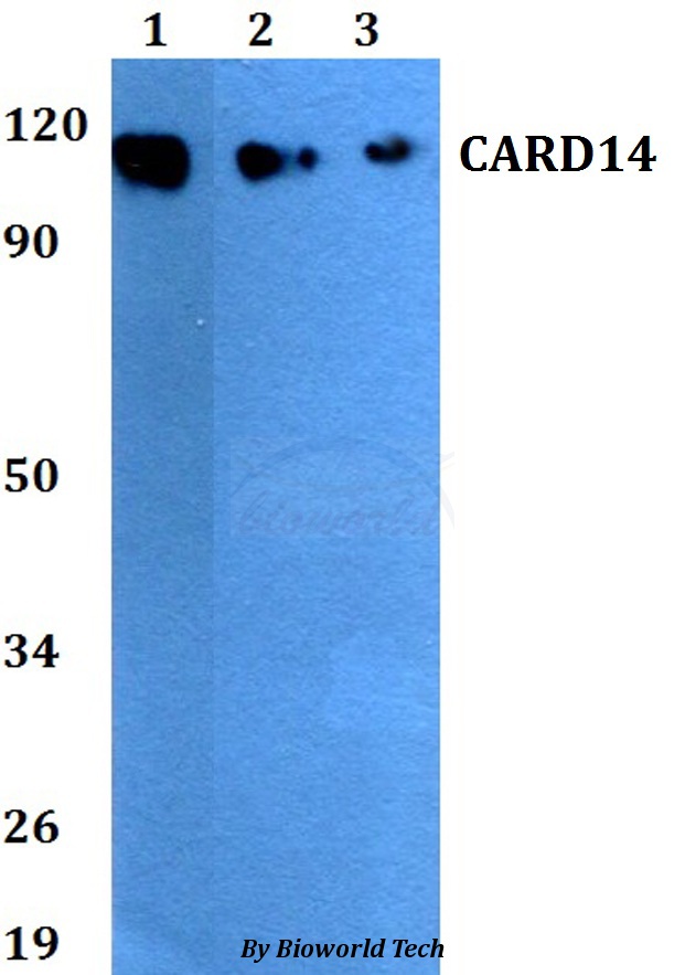 Anti-CARD14 Antibody
