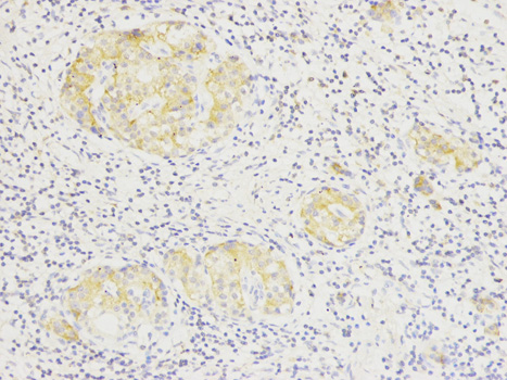 Anti-SIRT7 Antibody Anti-SIRT7 Antibody