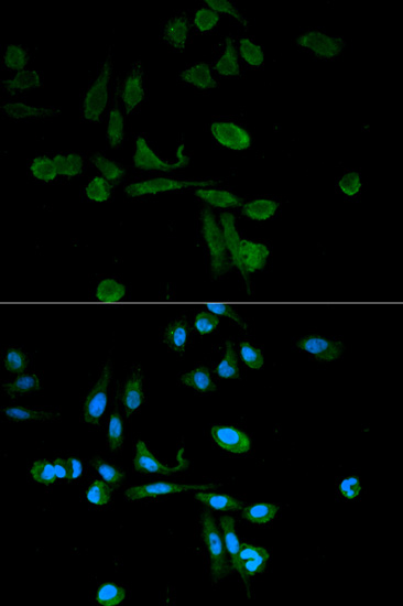 Anti-SIRT7 Antibody Anti-SIRT7 Antibody