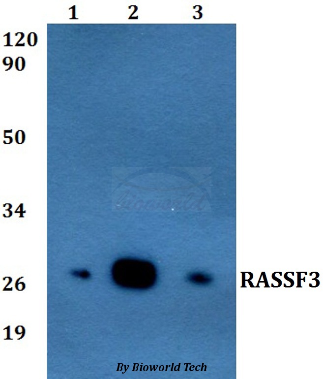 Anti-RASSF3 Antibody