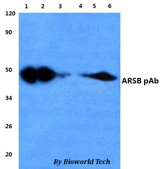Anti-ARSB Antibody