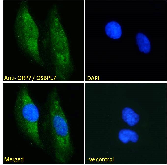 Anti-OSBPL7 Antibody