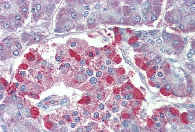 Anti-TRPM2 Antibody Anti-TRPM2 Antibody