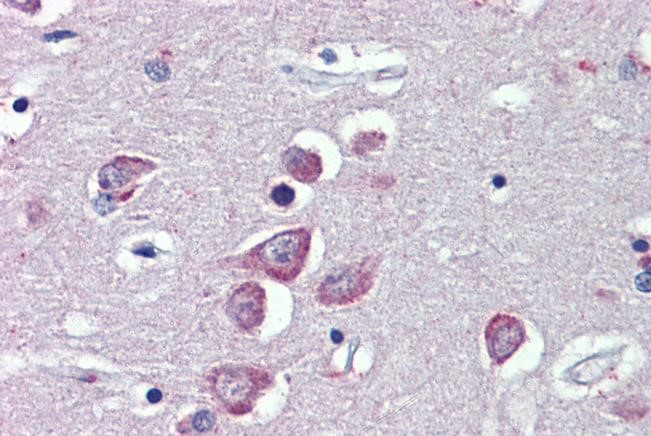 Anti-TRPM2 Antibody Anti-TRPM2 Antibody