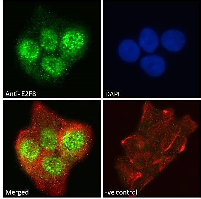 Anti-E2F8 Antibody