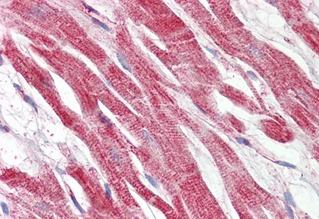 Anti-Hepcidin Antibody