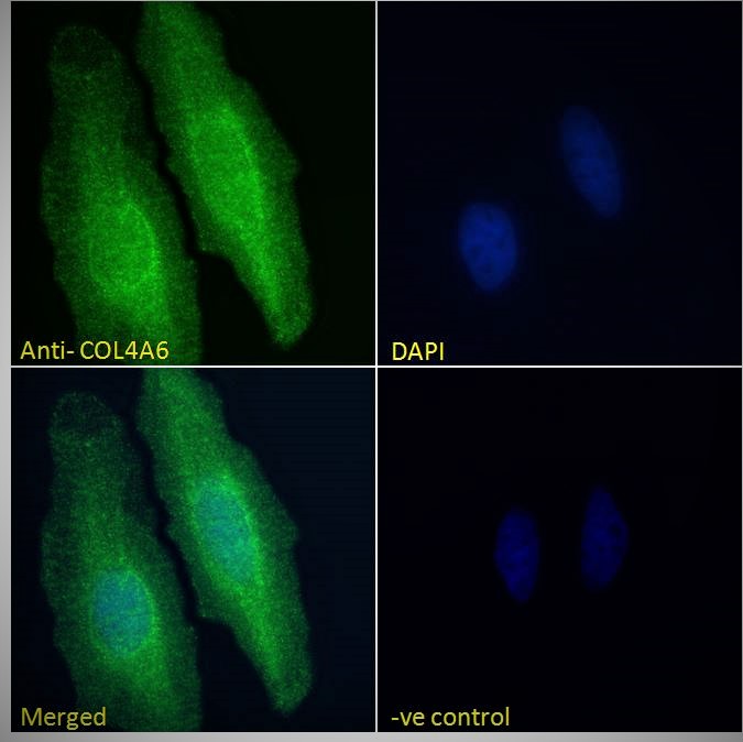 Anti-Collagen IV alpha 6 Antibody