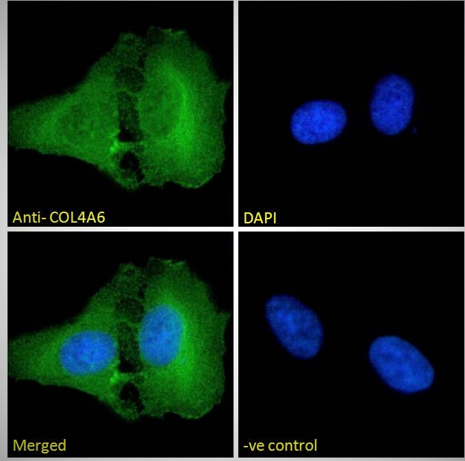 Anti-Collagen IV alpha 6 Antibody Anti-Collagen IV alpha 6 Antibody