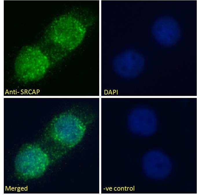 Anti-SRCAP Antibody