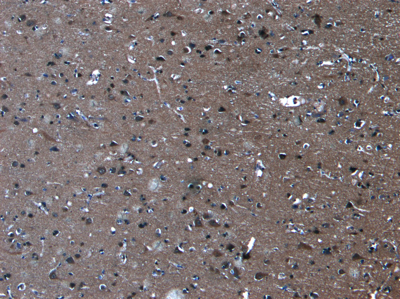 Anti-PCDH11Y/PCDH11X Antibody