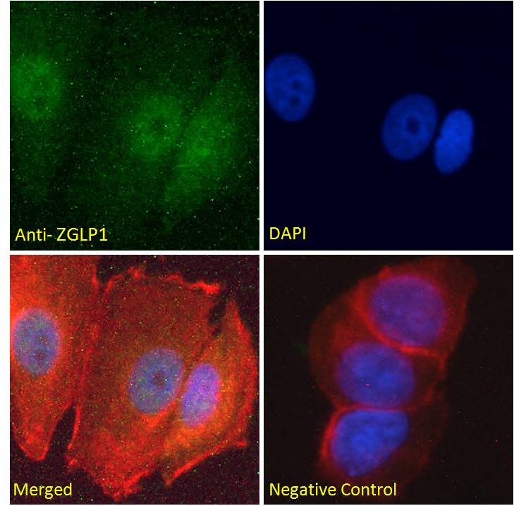 Anti-ZGLP1 Antibody