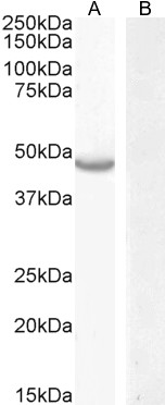 Anti-CETP Antibody
