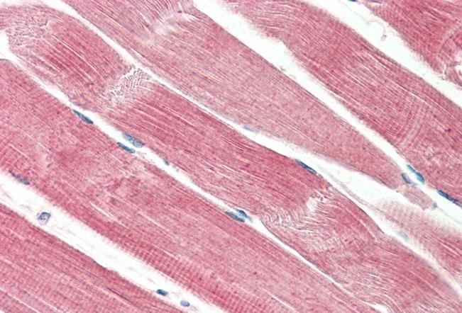 Anti-THNSL2 Antibody