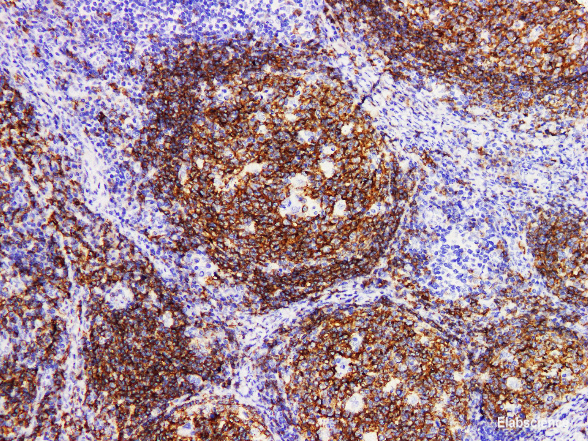 Anti-CD19 Antibody [YN00265r]