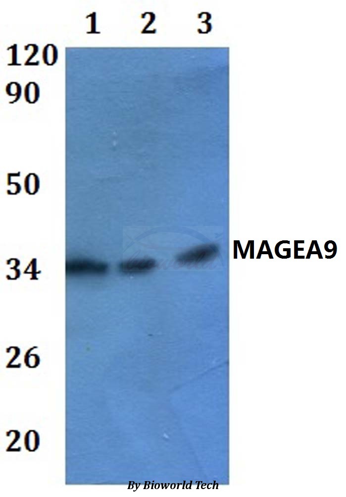 Anti-MAGEA9 Antibody