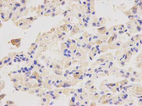 Anti-PSMD4 Antibody Anti-PSMD4 Antibody