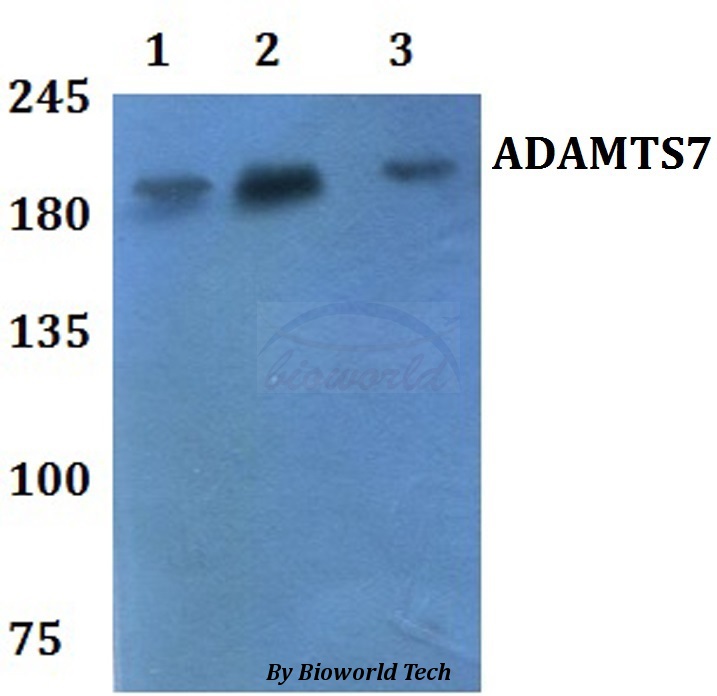 Anti-ADAMTS7 Antibody