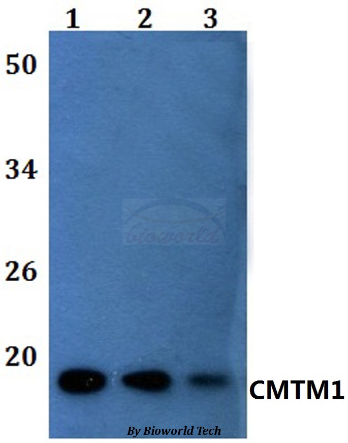Anti-CMTM1 Antibody