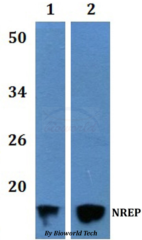 Anti-NREP Antibody