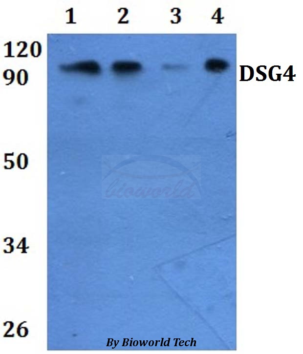 Anti-DSG4 Antibody