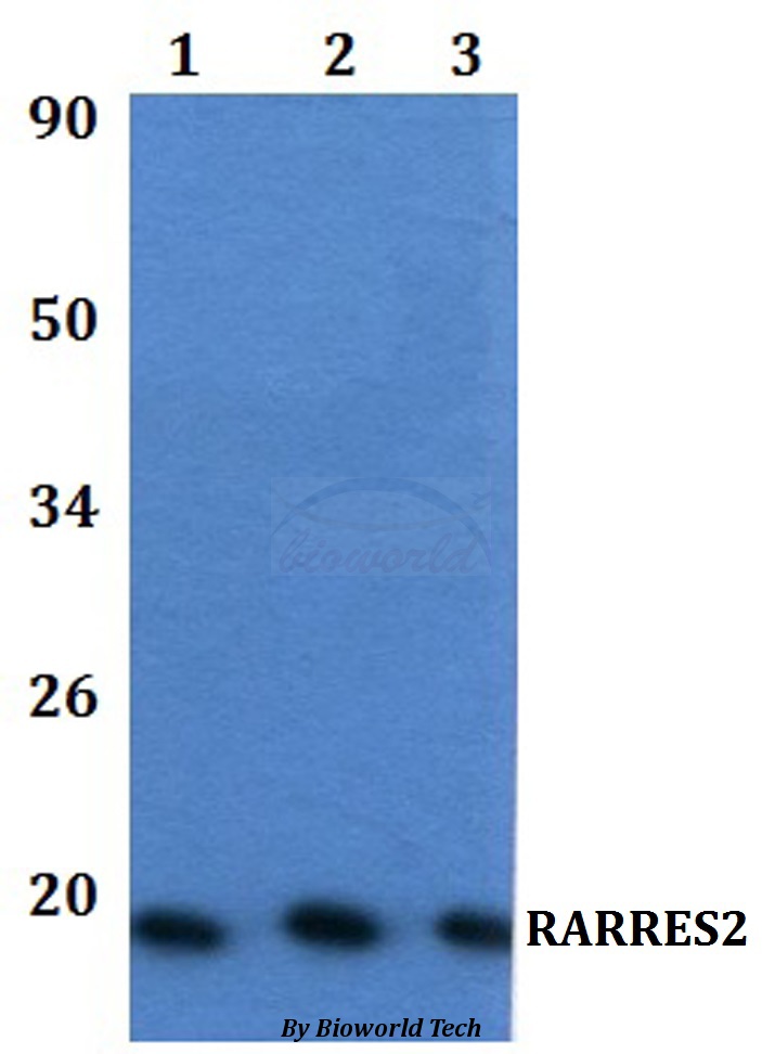 Anti-RARRES2 Antibody