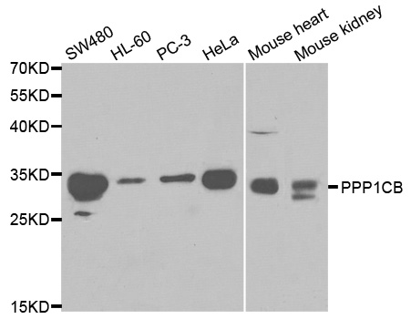 Anti-PPP1CB Antibody