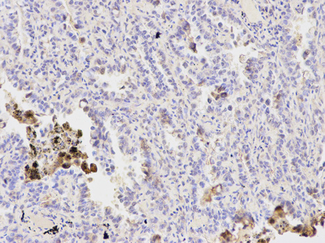 Anti-PPP1CB Antibody Anti-PPP1CB Antibody