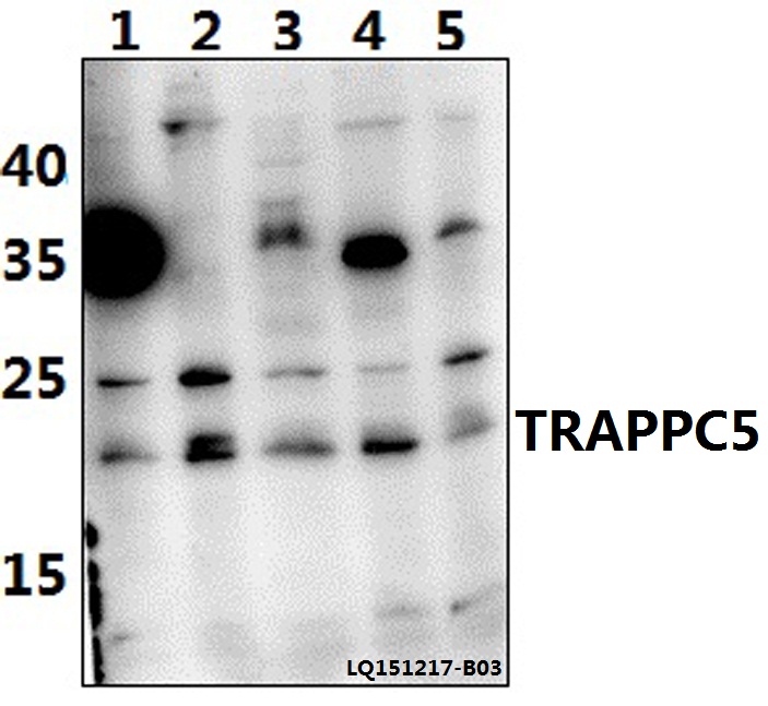 Anti-TRAPPC5 Antibody