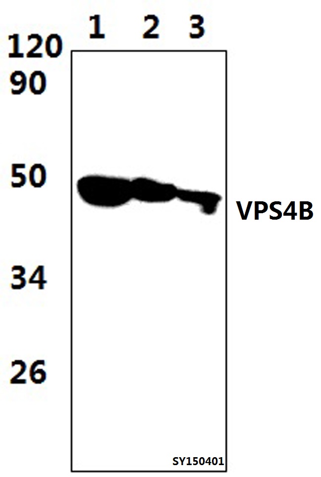 Anti-VPS4B Antibody