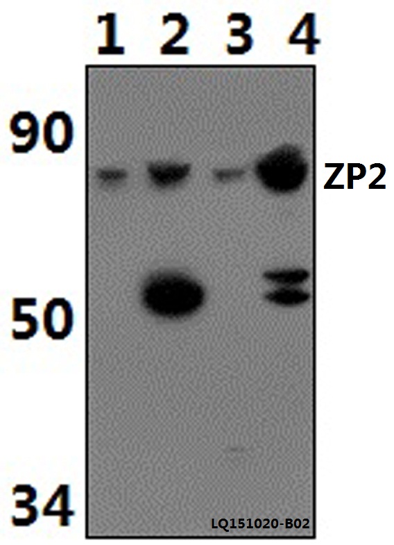 Anti-ZP2 Antibody