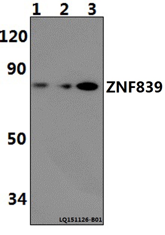 Anti-ZNF839 Antibody