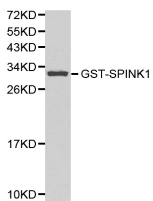 Anti-SPINK1 Antibody