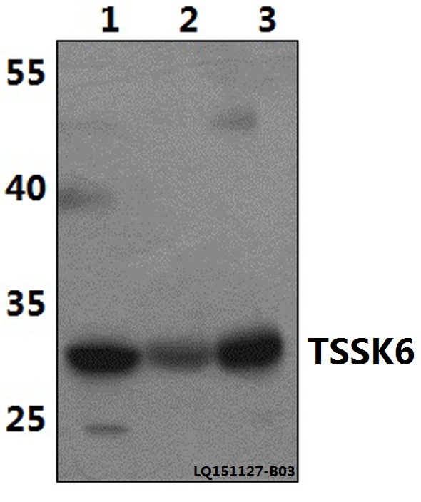 Anti-TSSK6 Antibody