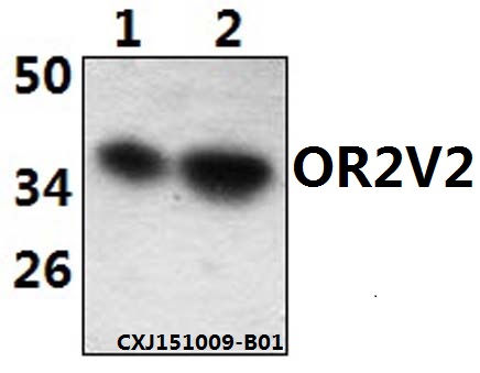 Anti-OR2V2 Antibody