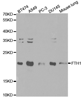 Anti-FTH1 Antibody