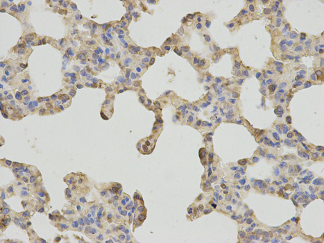 Anti-FTH1 Antibody Anti-FTH1 Antibody