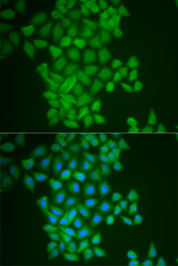 Anti-FTH1 Antibody Anti-FTH1 Antibody
