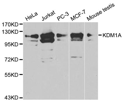 Anti-KDM1A Antibody