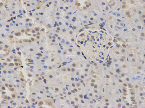 Anti-KDM1A Antibody Anti-KDM1A Antibody