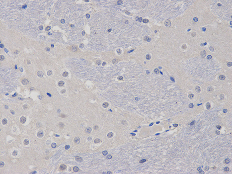 Anti-TCL1A Antibody Anti-TCL1A Antibody